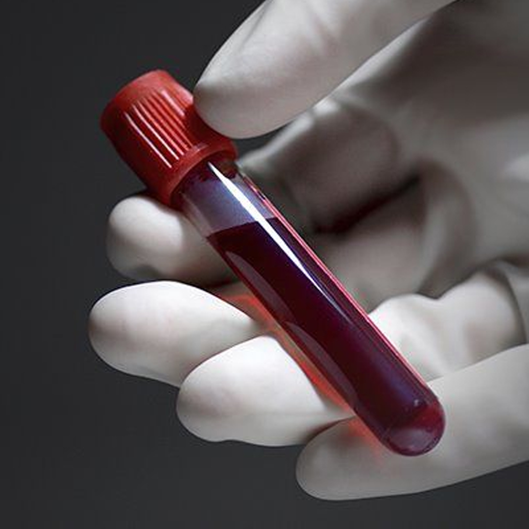 Blood Collection available in online  pharmacy qatar, doha 